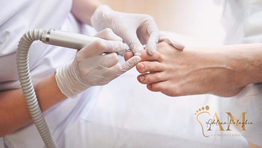 Pedichiura medicală: esențială pentru sănătatea picioarelor, nu un moft estetic