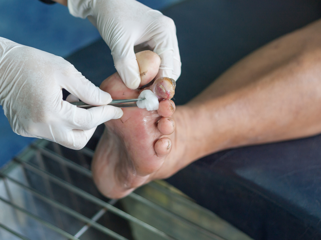 Rolul invizibil al podologului. Și greșeala sistemică de a-l ignora